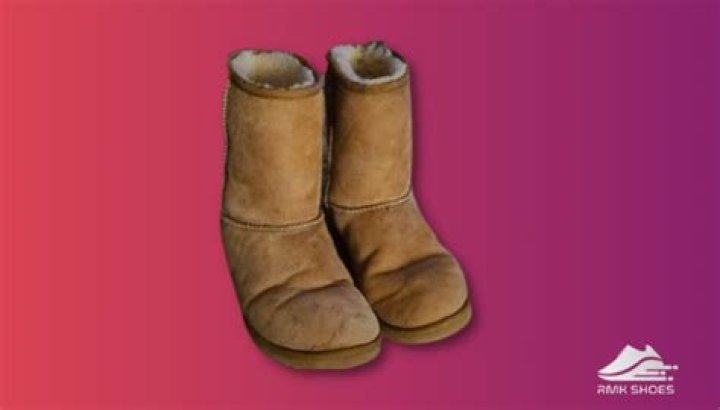 Are UGGs good for your feet?