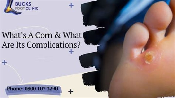 Can you pull a corn out of your foot?