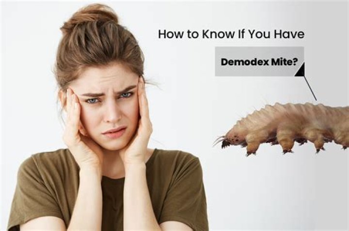 How do you know if you have Demodex mites?
