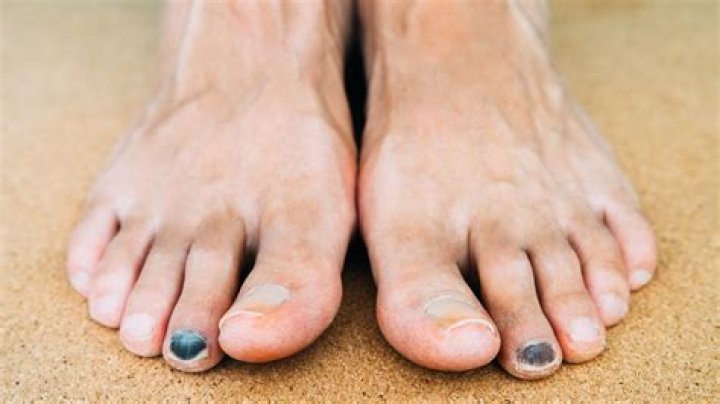 How do you run without damaging your joints?
